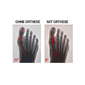 Epitact Pharma Hallux Valgus Bunion Corrector